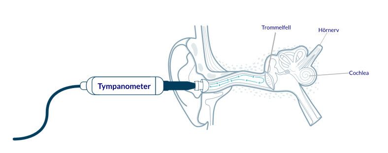 Grafik Tympanometer Messung