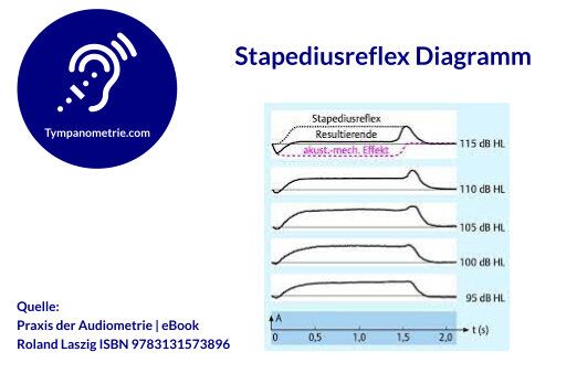 Stapediusreflex Diagramm | Praxis der Audiometrie (Ebook) von Roland Laszig